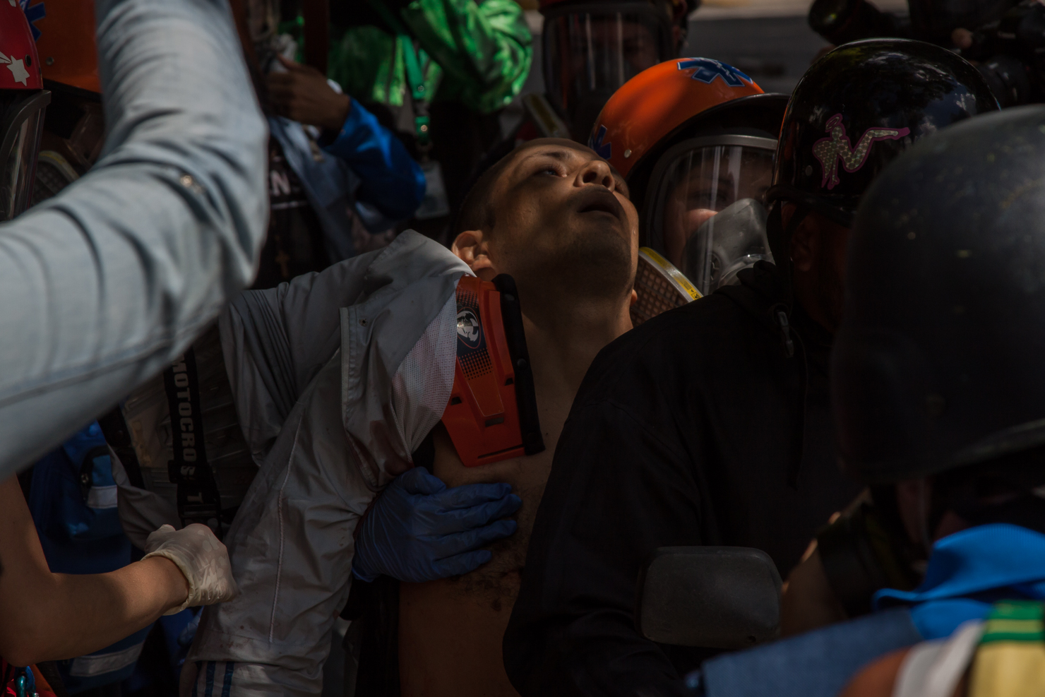Decenas de estudiantes resultaron heridos durante los enfrentamientos. CORTESÍA / PI